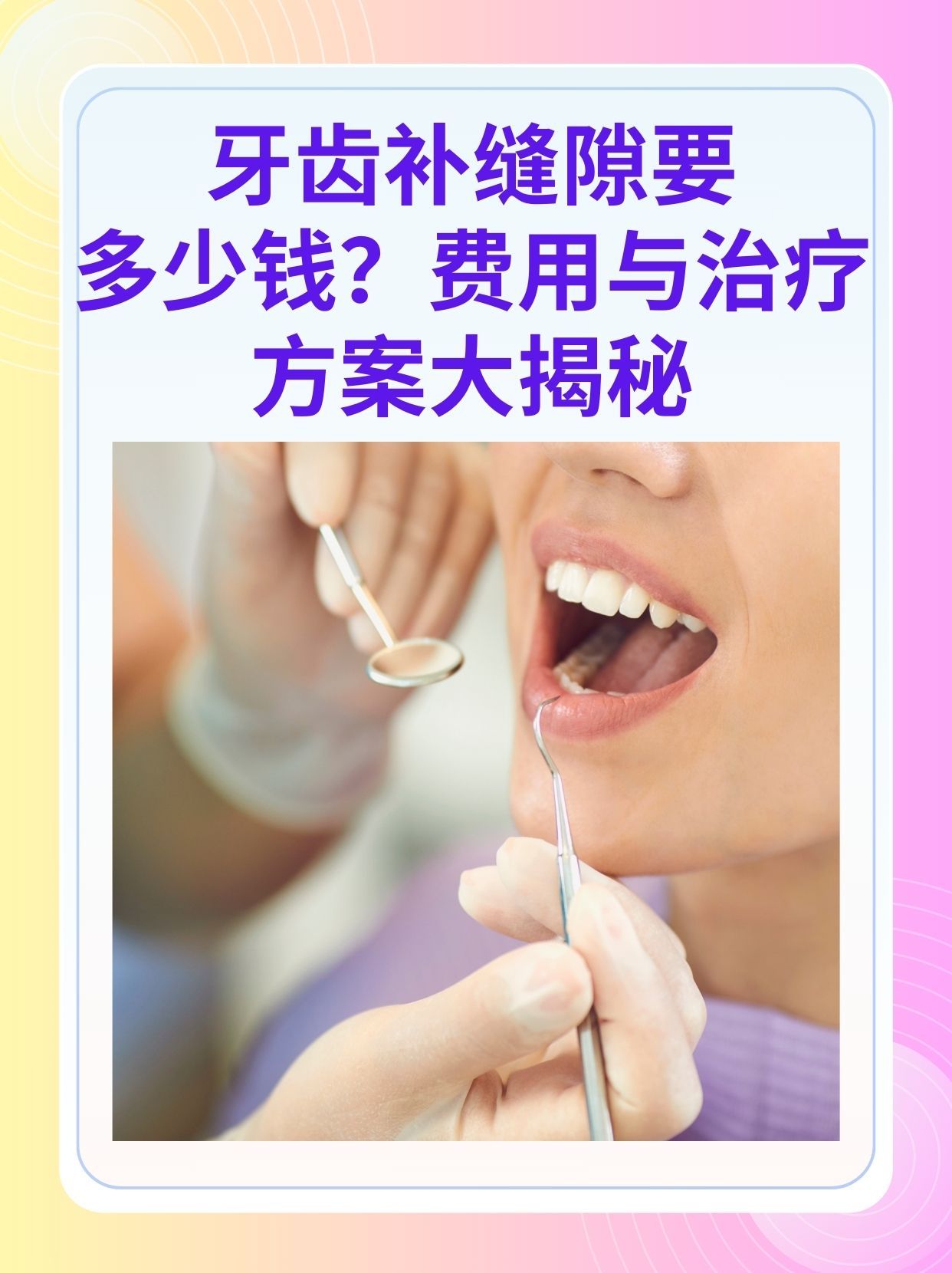 鹤岗补牙医保可以报销吗(补牙医保可以报销吗 哪些可以报销呢)